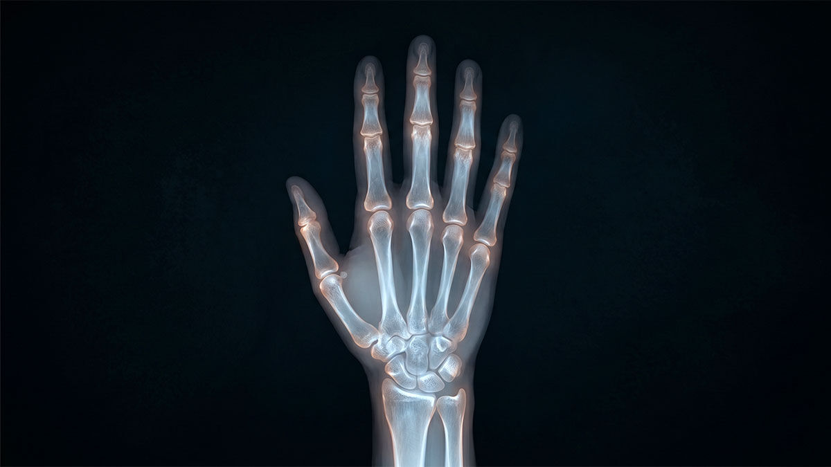 A human hand with its bones glowing visible through the flesh, evoking the first X-ray — the body's hidden interior made visible